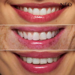 Olejek do ust Magic: PINK TINT EFFECT Olejek do ust Magic: PINK TINT EFFECT